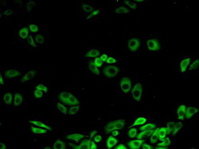 Polyclonal Antibody to Calcyclin Binding Protein (CACYBP)