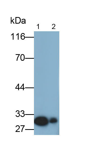 Polyclonal Antibody to Calcyclin Binding Protein (CACYBP)