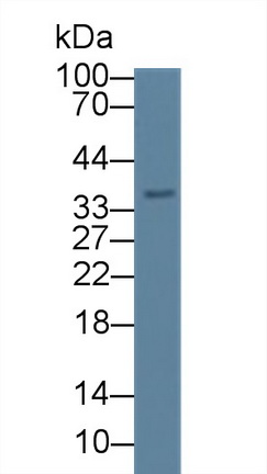 Polyclonal Antibody to Calcium Modulating Ligand (CAMLG)