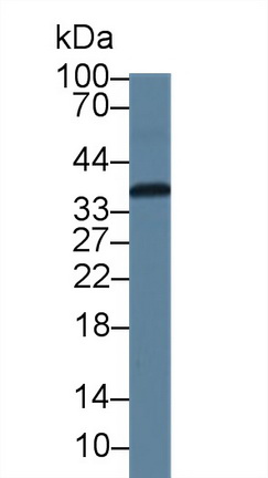 Polyclonal Antibody to Calcium Modulating Ligand (CAMLG)