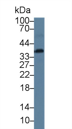 Polyclonal Antibody to Calcium Modulating Ligand (CAMLG)