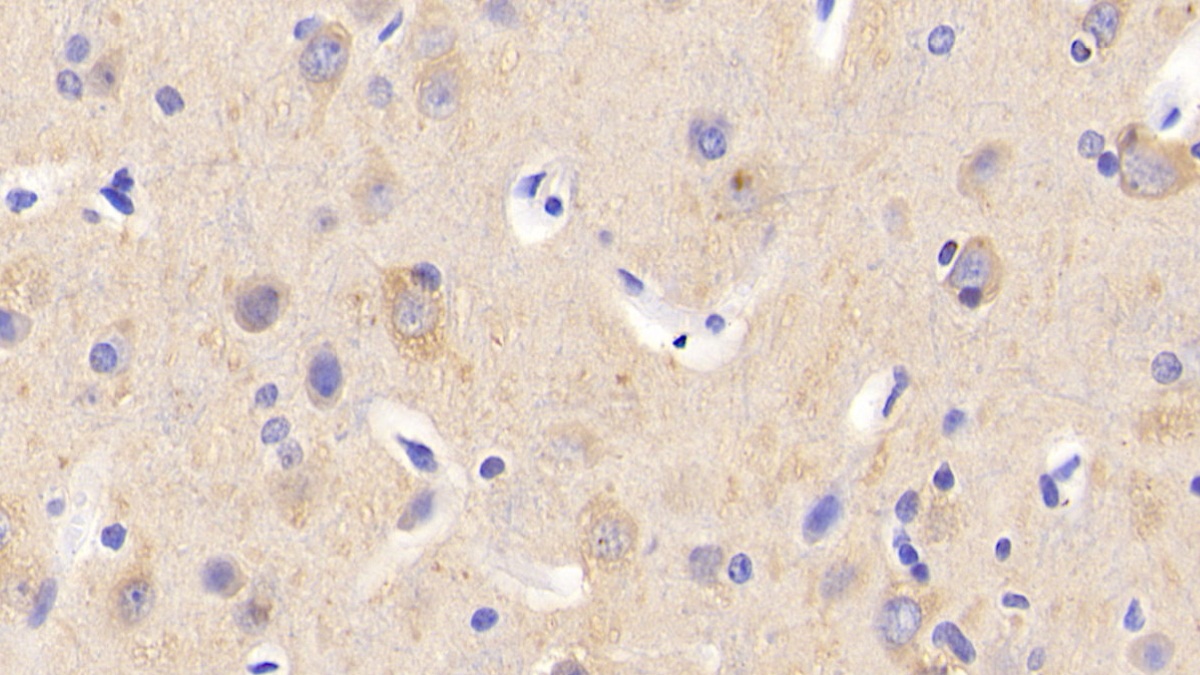 Polyclonal Antibody to Calcium Modulating Ligand (CAMLG)