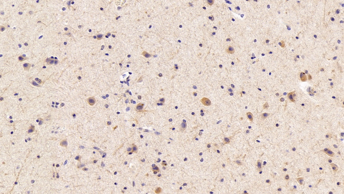 Polyclonal Antibody to Calcium Modulating Ligand (CAMLG)