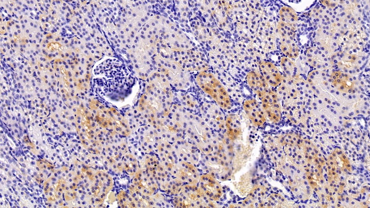 Polyclonal Antibody to Calcium Modulating Ligand (CAMLG)