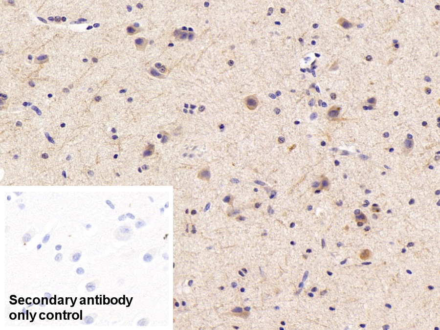 Polyclonal Antibody to Calcium Modulating Ligand (CAMLG)