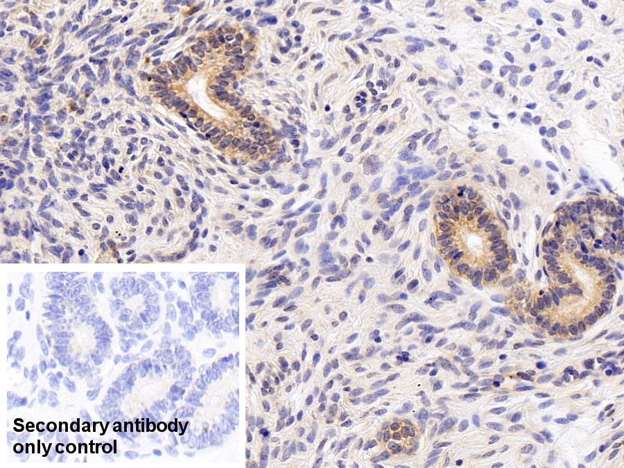 Polyclonal Antibody to Calcium Modulating Ligand (CAMLG)