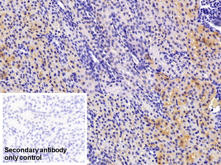 Polyclonal Antibody to Calcium Modulating Ligand (CAMLG)