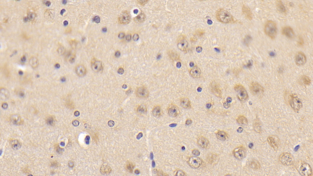 Polyclonal Antibody to Calcium Modulating Ligand (CAMLG)