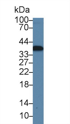 Polyclonal Antibody to Calcium Modulating Ligand (CAMLG)