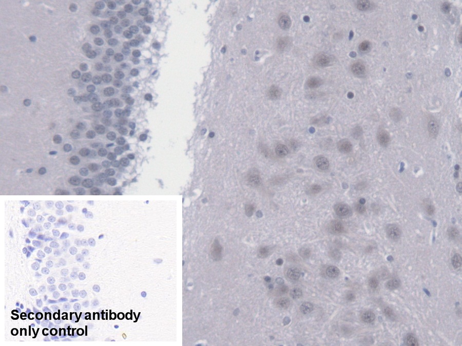 Polyclonal Antibody to Calcium Modulating Ligand (CAMLG)