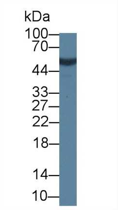 Polyclonal Antibody to Calcium Activated Nucleotidase 1 (CANT1)