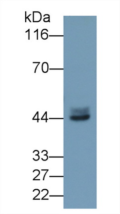 Polyclonal Antibody to Calcium Activated Nucleotidase 1 (CANT1)