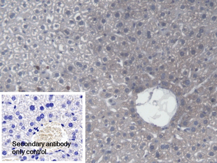 Polyclonal Antibody to Calcium Activated Nucleotidase 1 (CANT1)