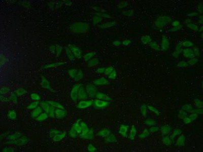 Polyclonal Antibody to Calpain 2 (CAPN2)