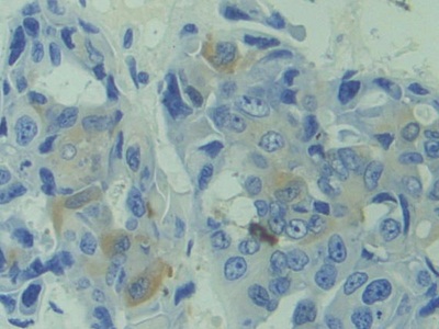 Polyclonal Antibody to Calcyphosine (CAPS)