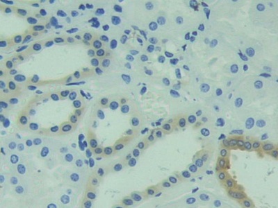 Polyclonal Antibody to Calcyphosine (CAPS)