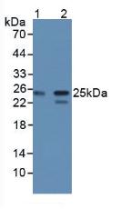 Polyclonal Antibody to Core Binding Factor Beta Subunit (CBFb)