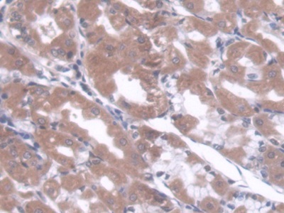 Polyclonal Antibody to Core Binding Factor Beta Subunit (CBFb)