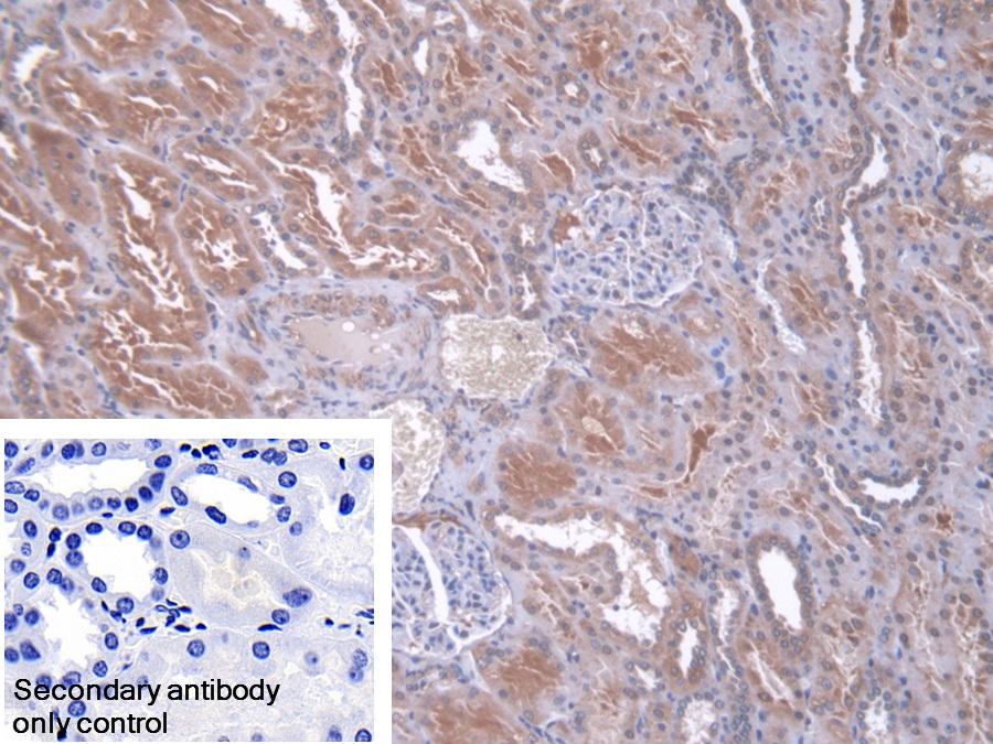 Polyclonal Antibody to Core Binding Factor Beta Subunit (CBFb)