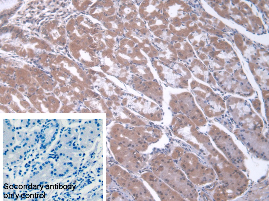 Polyclonal Antibody to Core Binding Factor Beta Subunit (CBFb)