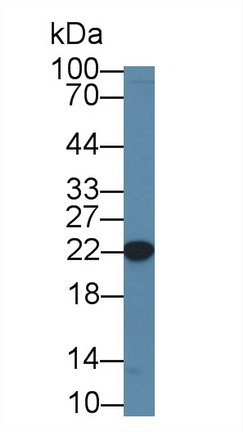 Polyclonal Antibody to Core Binding Factor Beta Subunit (CBFb)