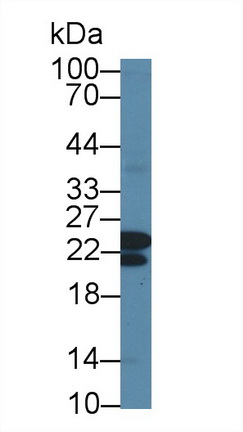 Polyclonal Antibody to Core Binding Factor Beta Subunit (CBFb)