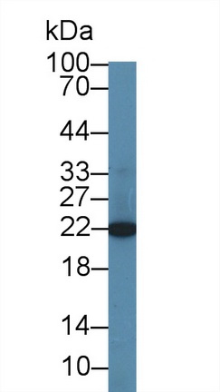 Polyclonal Antibody to Core Binding Factor Beta Subunit (CBFb)