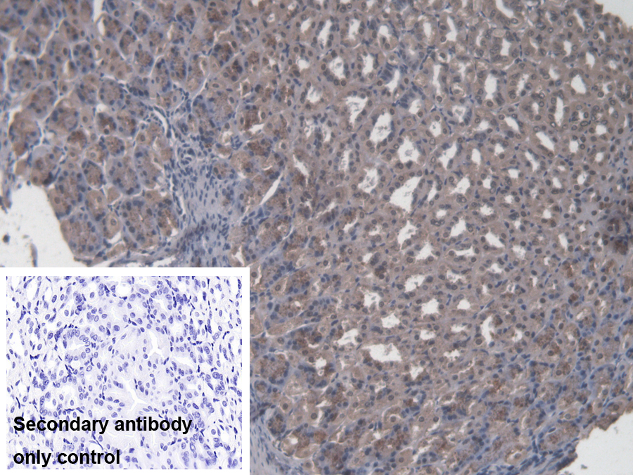 Polyclonal Antibody to Core Binding Factor Beta Subunit (CBFb)