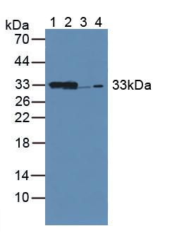 Polyclonal Antibody to Carbonyl Reductase 1 (CBR1)