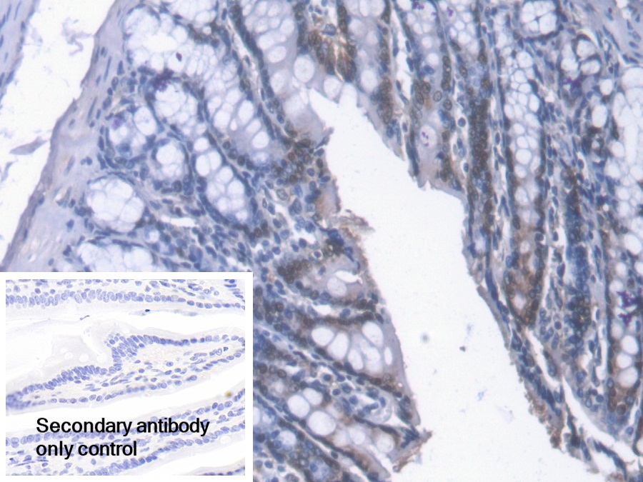 Polyclonal Antibody to Carbonyl Reductase 1 (CBR1)