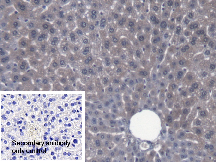 Polyclonal Antibody to Carbonyl Reductase 1 (CBR1)