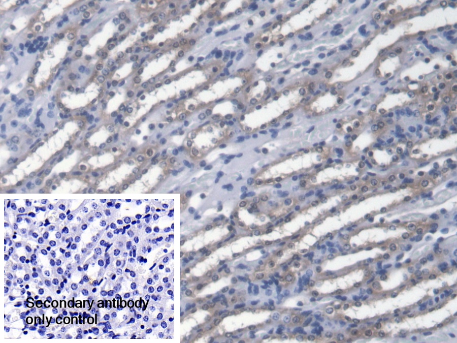 Polyclonal Antibody to Carbonyl Reductase 1 (CBR1)