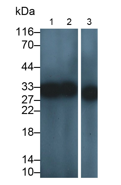 Polyclonal Antibody to Carbonyl Reductase 1 (CBR1)