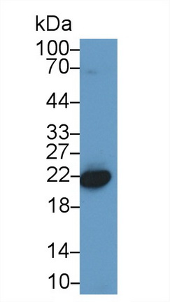 Polyclonal Antibody to Chromobox Homolog 3 (CBX3)