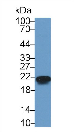 Polyclonal Antibody to Chromobox Homolog 3 (CBX3)