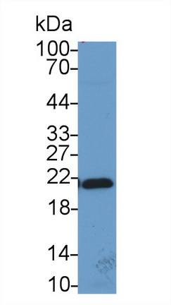 Polyclonal Antibody to Chromobox Homolog 3 (CBX3)