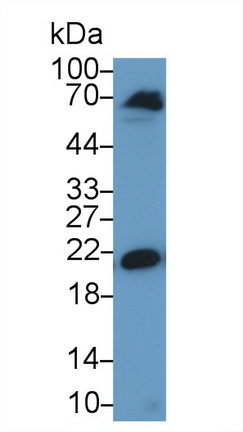 Polyclonal Antibody to Chromobox Homolog 3 (CBX3)