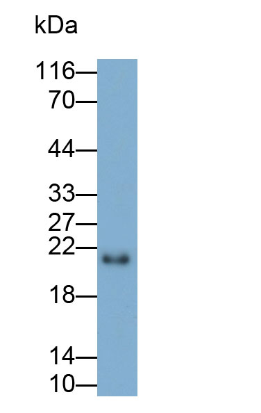 Polyclonal Antibody to Chromobox Homolog 3 (CBX3)