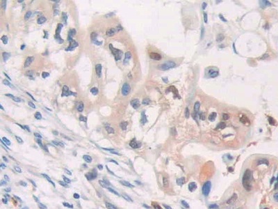 Polyclonal Antibody to Cytidine Deaminase (CDA)