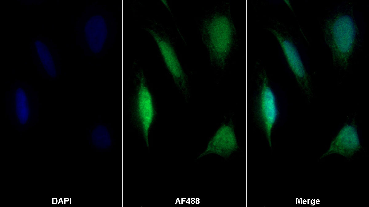 Polyclonal Antibody to Cytidine Deaminase (CDA)