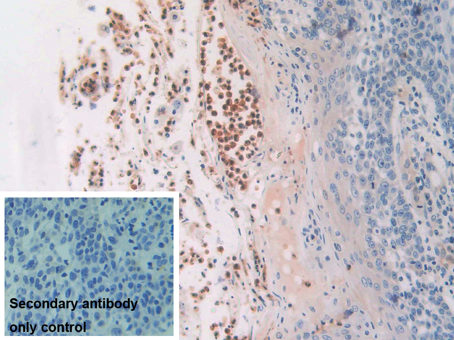 Polyclonal Antibody to Cytidine Deaminase (CDA)