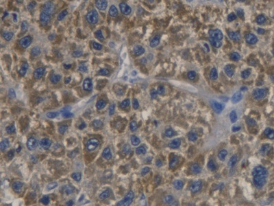 Polyclonal Antibody to Cyclin Dependent Kinase Inhibitor 3 (CDKN3)