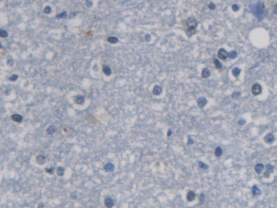 Polyclonal Antibody to Cyclin Dependent Kinase Inhibitor 3 (CDKN3)