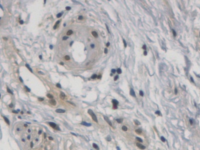 Polyclonal Antibody to Cyclin Dependent Kinase Inhibitor 3 (CDKN3)