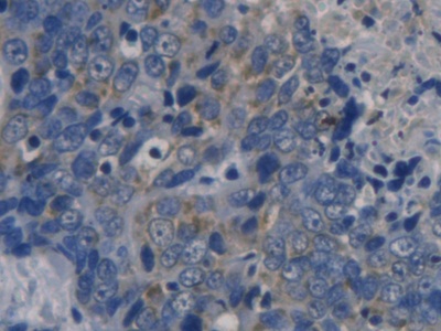 Polyclonal Antibody to Cyclin Dependent Kinase Inhibitor 3 (CDKN3)