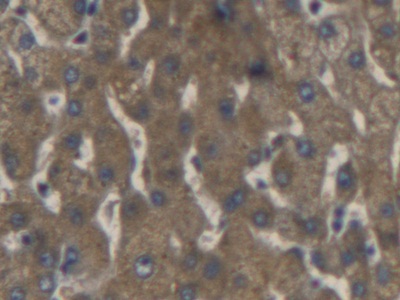 Polyclonal Antibody to Cyclin Dependent Kinase Inhibitor 3 (CDKN3)