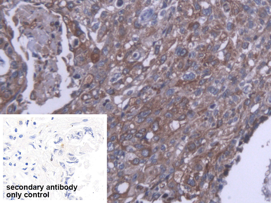 Polyclonal Antibody to Carboxylesterase 1 (CES1)