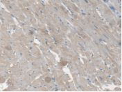 Polyclonal Antibody to Carboxylesterase 1 (CES1)