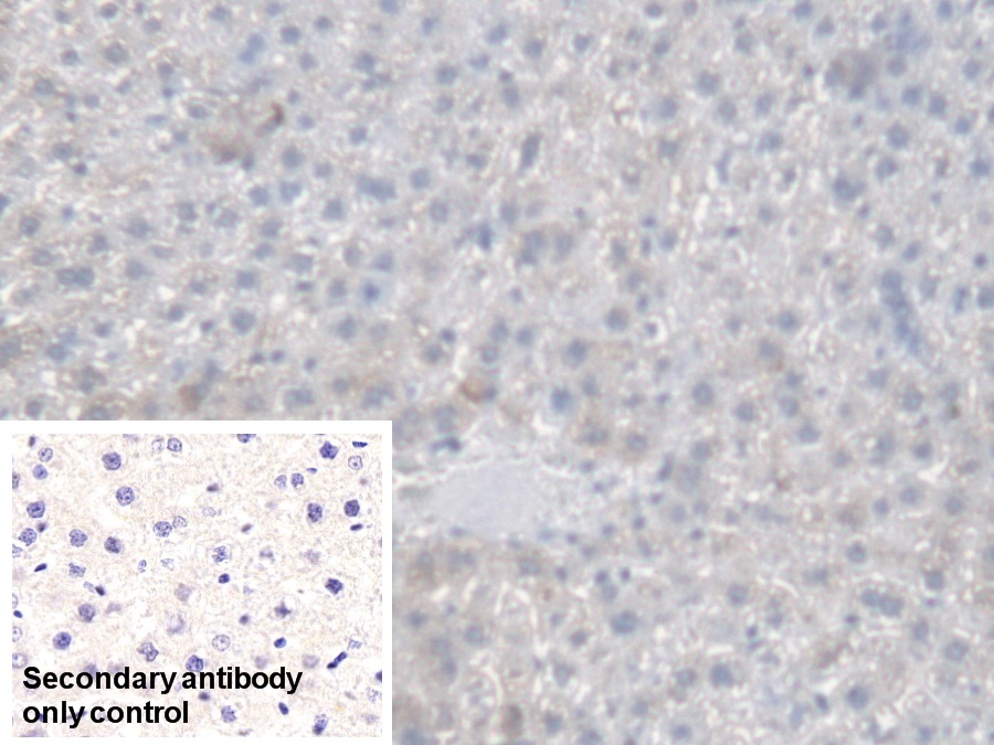 Polyclonal Antibody to Carboxylesterase 1 (CES1)