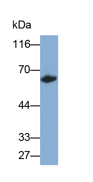 Polyclonal Antibody to Carboxylesterase 1 (CES1)